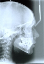 Cephalometric Radiograph (orthodontic example)